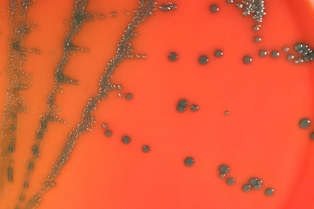 Kolonie Listeria monocytogenes na chromogenní půdě